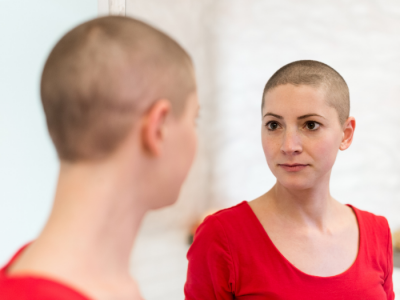 Comprendiendo la alopecia