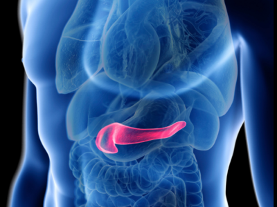 ¿Qué sabemos del cáncer de páncreas?