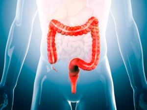 Lee más sobre el artículo Pruebas moleculares en el cáncer de colón y recto (CCR) y la selección de tratamiento